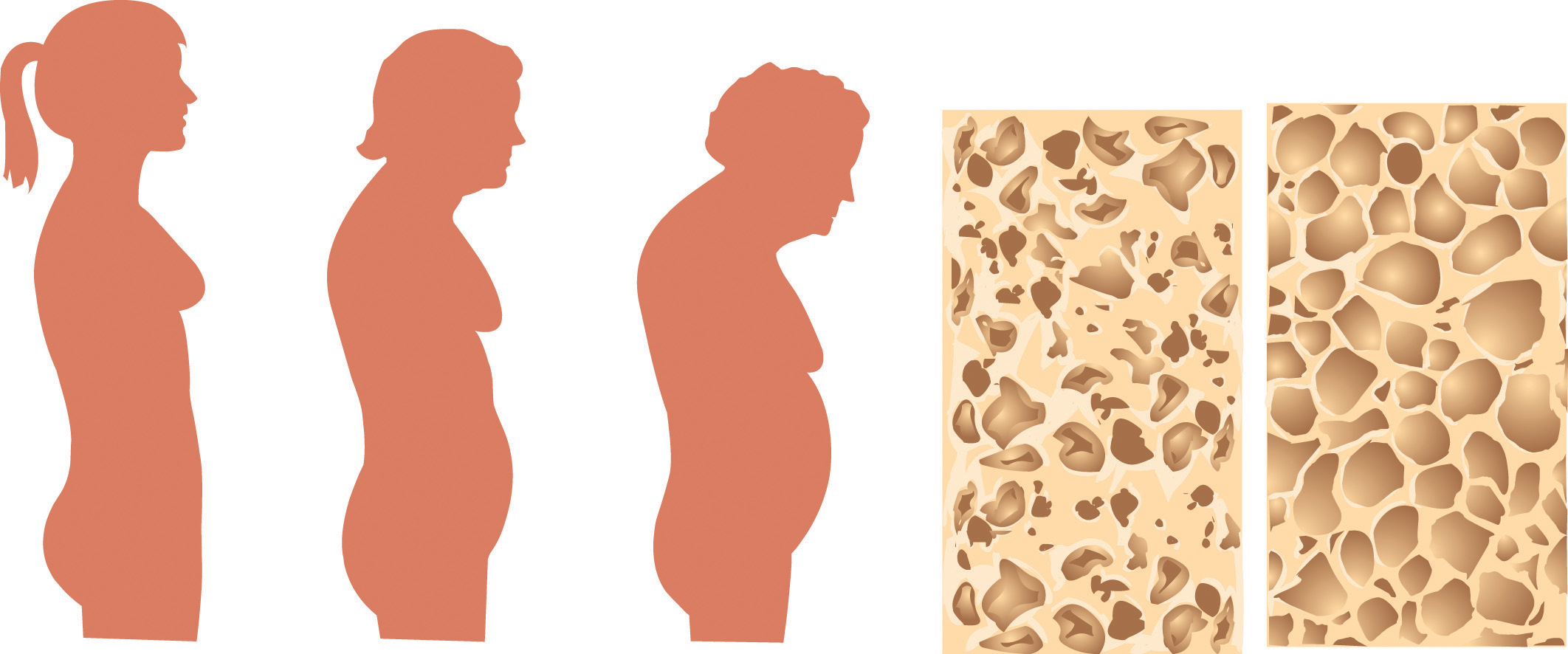 Nutrients Important For Bone Health